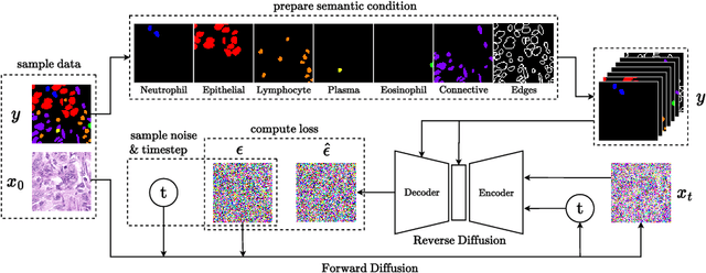 Figure 1 for NASDM: Nuclei-Aware Semantic Histopathology Image Generation Using Diffusion Models