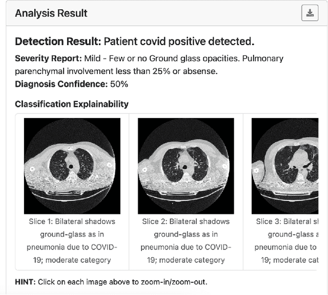 Figure 4 for COVID-19 Computer-aided Diagnosis through AI-assisted CT Imaging Analysis: Deploying a Medical AI System