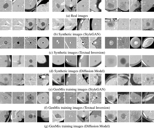 Figure 4 for GenMix: Combining Generative and Mixture Data Augmentation for Medical Image Classification