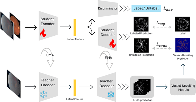 Figure 2 for Adversarial Vessel-Unveiling Semi-Supervised Segmentation for Retinopathy of Prematurity Diagnosis