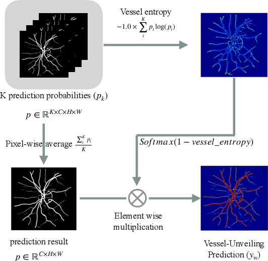 Figure 3 for Adversarial Vessel-Unveiling Semi-Supervised Segmentation for Retinopathy of Prematurity Diagnosis