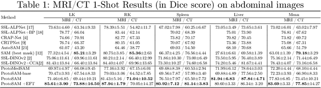 Figure 2 for ProtoSAM -- One Shot Medical Image Segmentation With Foundational Models