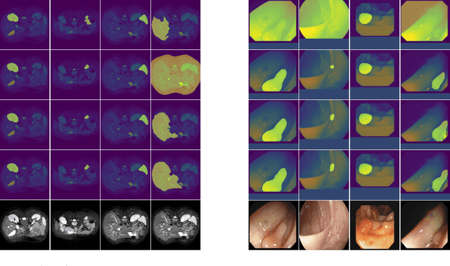 Figure 4 for ProtoSAM -- One Shot Medical Image Segmentation With Foundational Models