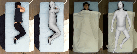 Figure 1 for Multi-modal 3D Pose and Shape Estimation with Computed Tomography