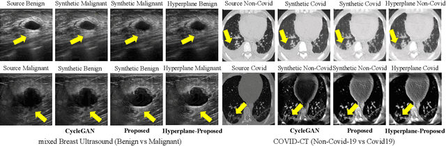 Figure 3 for A Parameterized Generative Adversarial Network Using Cyclic Projection for Explainable Medical Image Classification