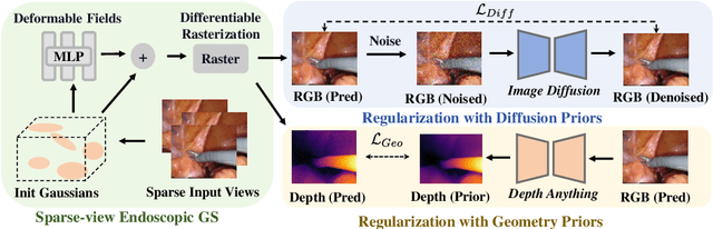 Figure 1 for EndoSparse: Real-Time Sparse View Synthesis of Endoscopic Scenes using Gaussian Splatting