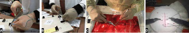 Figure 1 for Kinematic Data-Based Action Segmentation for Surgical Applications