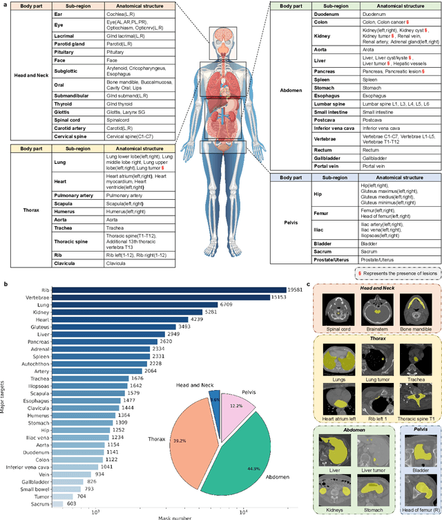 Figure 3 for SegVol: Universal and Interactive Volumetric Medical Image Segmentation