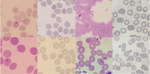 Figure 2 for Assessing Generalization Capabilities of Malaria Diagnostic Models from Thin Blood Smears