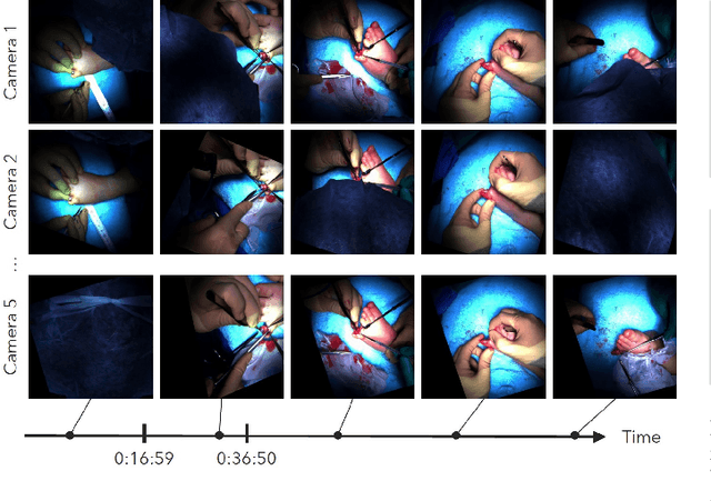 Figure 4 for Disturbance-Free Surgical Video Generation from Multi-Camera Shadowless Lamps for Open Surgery