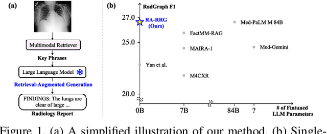 Figure 1 for Leveraging LLMs for Multimodal Retrieval-Augmented Radiology Report Generation via Key Phrase Extraction