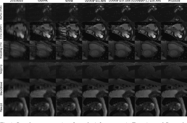 Figure 2 for Deep Multi-contrast Cardiac MRI Reconstruction via vSHARP with Auxiliary Refinement Network