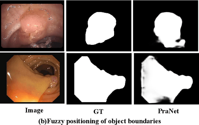 Figure 1 for HiFiSeg: High-Frequency Information Enhanced Polyp Segmentation with Global-Local Vision Transformer