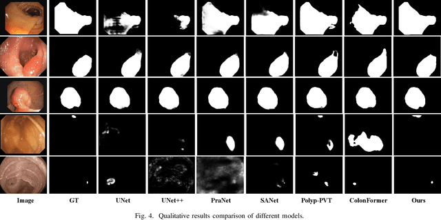 Figure 4 for HiFiSeg: High-Frequency Information Enhanced Polyp Segmentation with Global-Local Vision Transformer