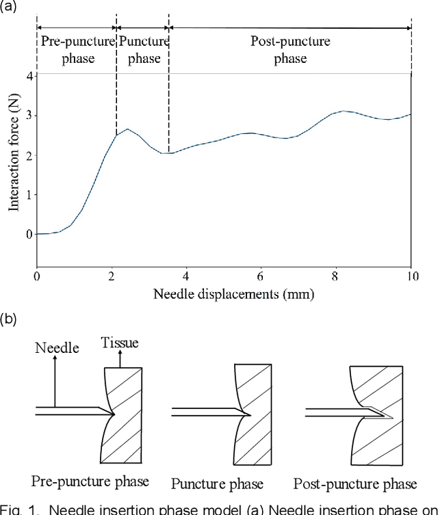 Figure 1 for Transformer Based Tissue Classification in Robotic Needle Biopsy