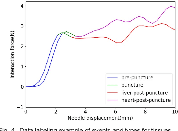 Figure 4 for Transformer Based Tissue Classification in Robotic Needle Biopsy