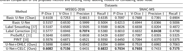 Figure 4 for Improving Multiple Sclerosis Lesion Segmentation Across Clinical Sites: A Federated Learning Approach with Noise-Resilient Training