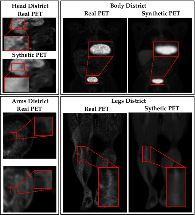 Figure 2 for Whole-Body Image-to-Image Translation for a Virtual Scanner in a Healthcare Digital Twin