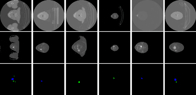 Figure 1 for MLC at HECKTOR 2022: The Effect and Importance of Training Data when Analyzing Cases of Head and Neck Tumors using Machine Learning