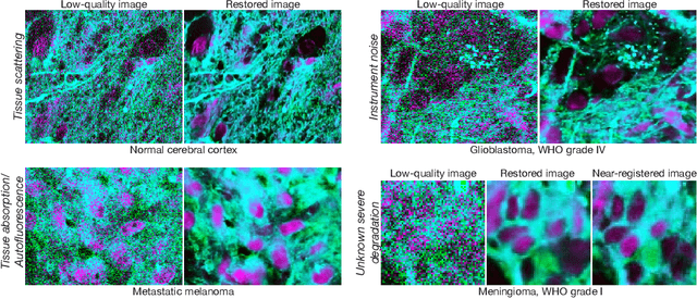 Figure 1 for Step-Calibrated Diffusion for Biomedical Optical Image Restoration