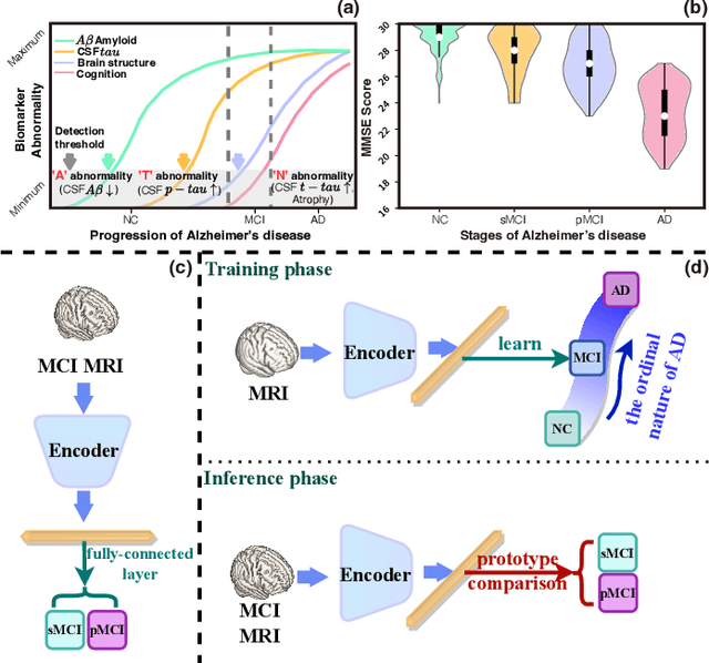 Figure 1 for HOPE: Hybrid-granularity Ordinal Prototype Learning for Progression Prediction of Mild Cognitive Impairment