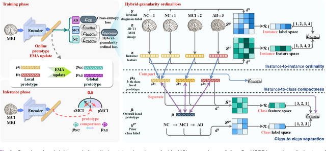 Figure 2 for HOPE: Hybrid-granularity Ordinal Prototype Learning for Progression Prediction of Mild Cognitive Impairment