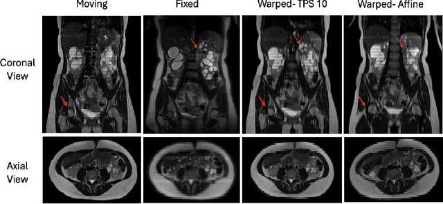 Figure 4 for RealKeyMorph: Keypoints in Real-world Coordinates for Resolution-agnostic Image Registration