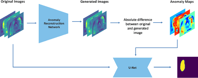 Figure 1 for Anomaly-Driven Approach for Enhanced Prostate Cancer Segmentation