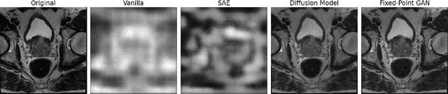 Figure 3 for Anomaly-Driven Approach for Enhanced Prostate Cancer Segmentation