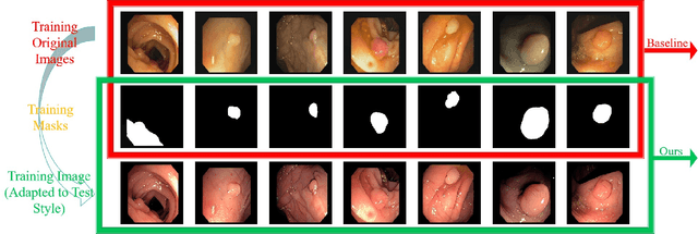 Figure 3 for Structure-Aware Stylized Image Synthesis for Robust Medical Image Segmentation