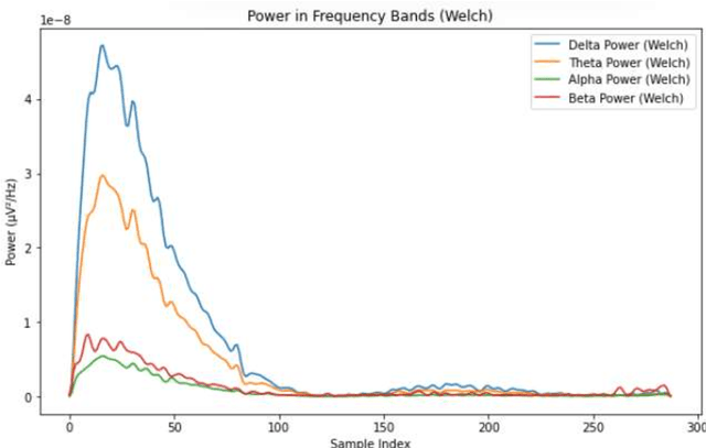 Figure 3 for Hybrid Quantum Deep Learning Model for Emotion Detection using raw EEG Signal Analysis