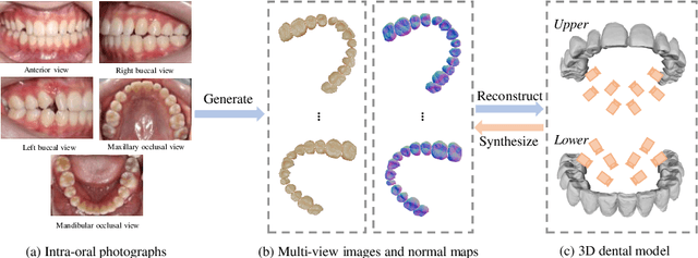 Figure 1 for TeethDreamer: 3D Teeth Reconstruction from Five Intra-oral Photographs