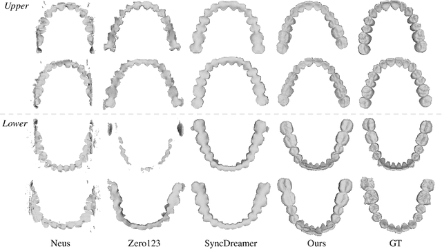 Figure 4 for TeethDreamer: 3D Teeth Reconstruction from Five Intra-oral Photographs