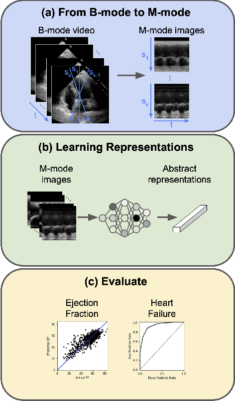 Figure 1 for M-mode Based Prediction of Ejection Fraction using Echocardiograms