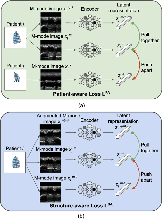 Figure 3 for M-mode Based Prediction of Ejection Fraction using Echocardiograms