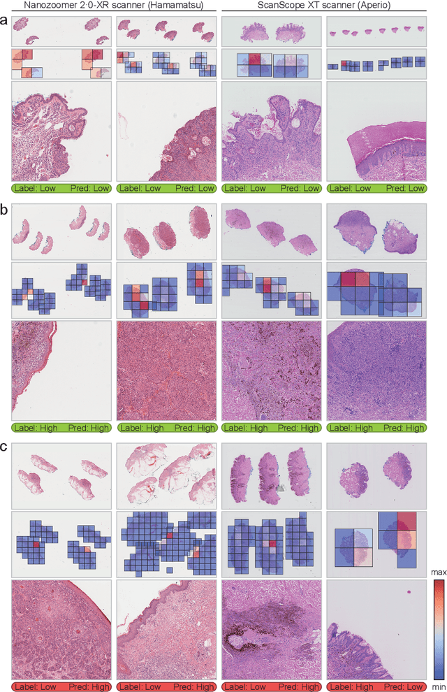 Figure 4 for Artificial Intelligence-Based Triaging of Cutaneous Melanocytic Lesions