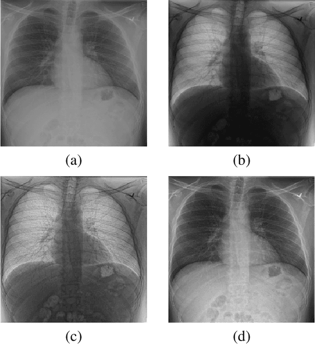 Figure 1 for Unsupervised Iterative U-Net with an Internal Guidance Layer for Vertebrae Contrast Enhancement in Chest X-Ray Images