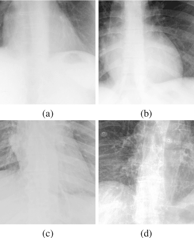 Figure 3 for Unsupervised Iterative U-Net with an Internal Guidance Layer for Vertebrae Contrast Enhancement in Chest X-Ray Images