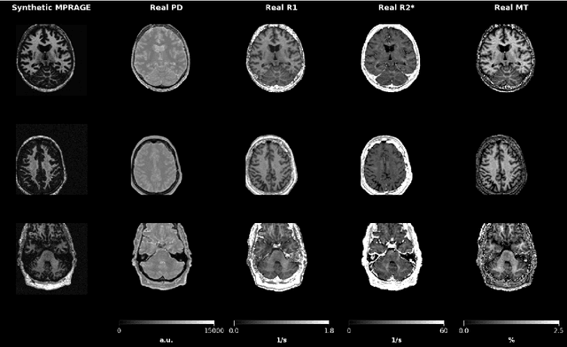 Figure 1 for Domain-Agnostic Stroke Lesion Segmentation Using Physics-Constrained Synthetic Data