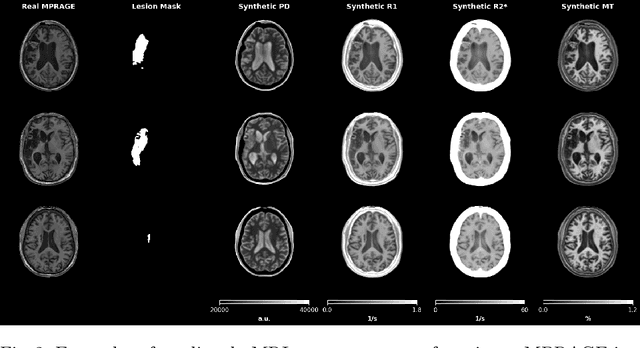 Figure 3 for Domain-Agnostic Stroke Lesion Segmentation Using Physics-Constrained Synthetic Data