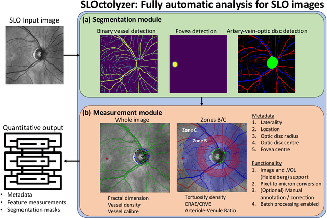 Figure 1 for SLOctolyzer: Fully automatic analysis toolkit for segmentation and feature extracting in scanning laser ophthalmoscopy images