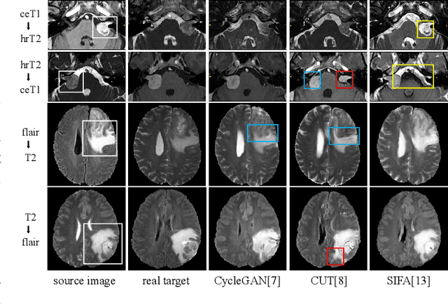 Figure 2 for FPL+: Filtered Pseudo Label-based Unsupervised Cross-Modality Adaptation for 3D Medical Image Segmentation