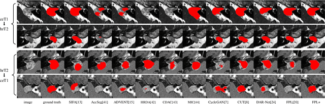 Figure 3 for FPL+: Filtered Pseudo Label-based Unsupervised Cross-Modality Adaptation for 3D Medical Image Segmentation