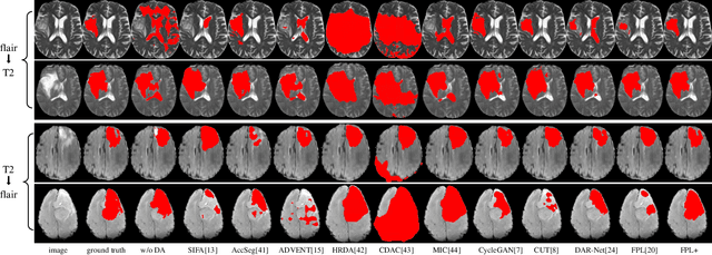 Figure 4 for FPL+: Filtered Pseudo Label-based Unsupervised Cross-Modality Adaptation for 3D Medical Image Segmentation