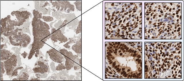 Figure 1 for EndoNet: model for automatic calculation of H-score on histological slides