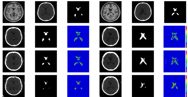 Figure 4 for CT-based brain ventricle segmentation via diffusion Schrödinger Bridge without target domain ground truths