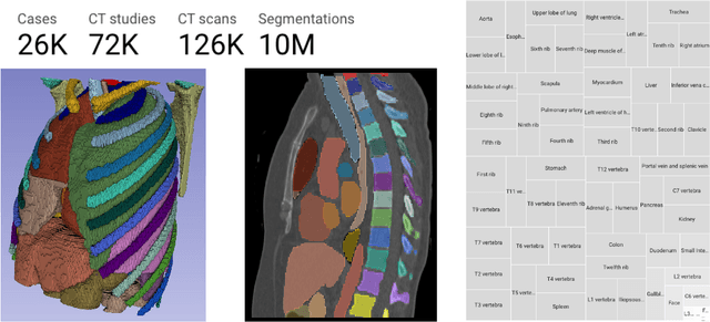 Figure 1 for Rule-based outlier detection of AI-generated anatomy segmentations