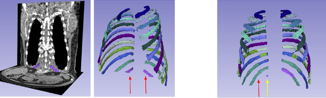 Figure 4 for Rule-based outlier detection of AI-generated anatomy segmentations