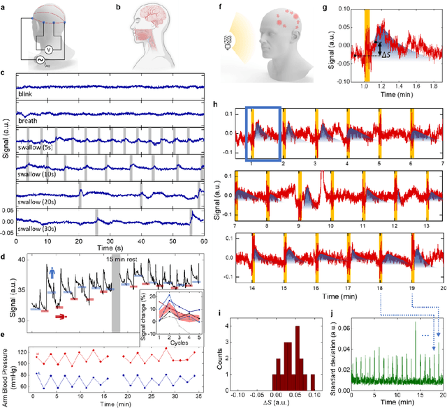 Figure 4 for Electrically functionalized body surface for deep-tissue bioelectrical recording