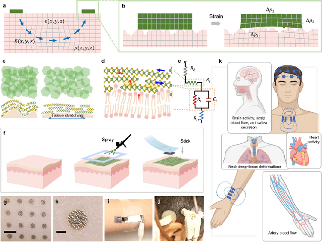 Figure 1 for Electrically functionalized body surface for deep-tissue bioelectrical recording